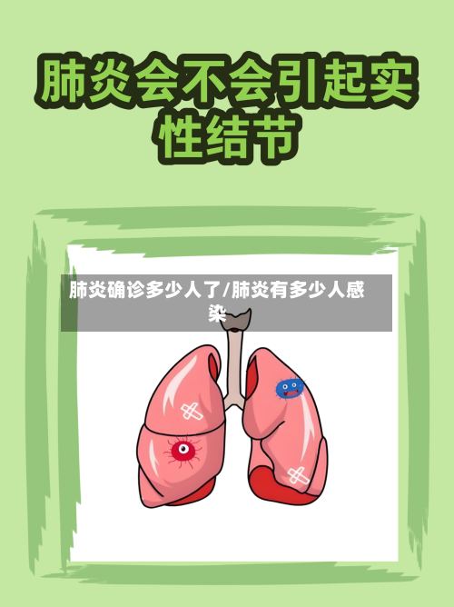 肺炎确诊多少人了/肺炎有多少人感染