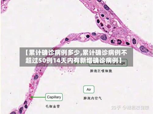 【累计确诊病例多少,累计确诊病例不超过50例14天内有新增确诊病例】
