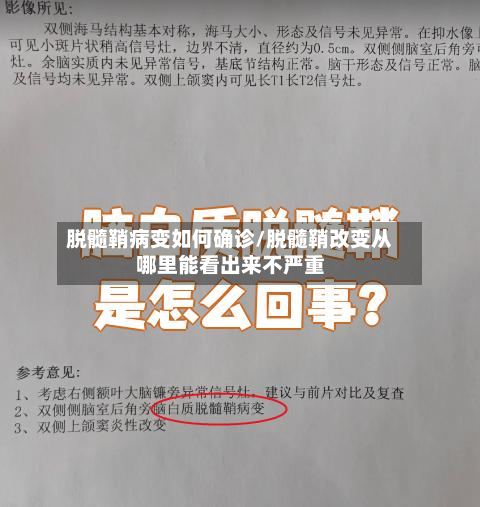 脱髓鞘病变如何确诊/脱髓鞘改变从哪里能看出来不严重