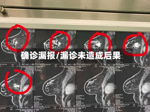 确诊漏报/漏诊未造成后果-第2张图片