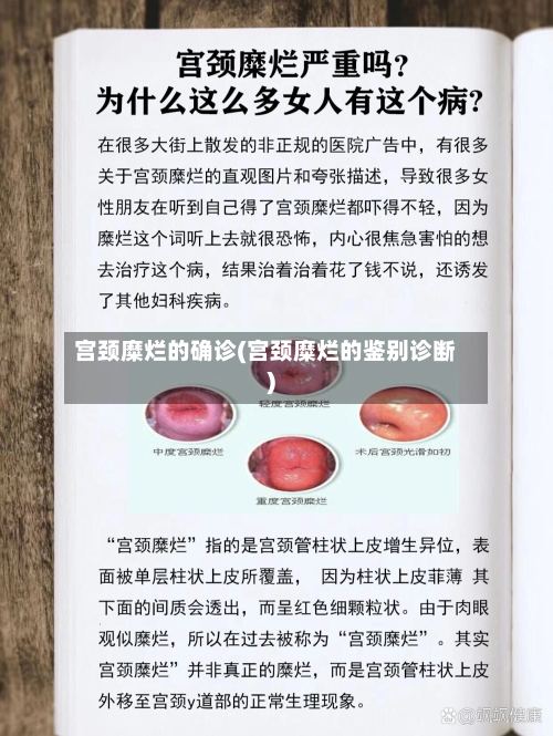 宫颈糜烂的确诊(宫颈糜烂的鉴别诊断)