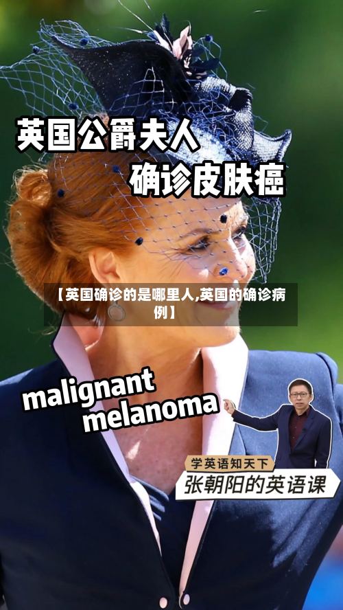 【英国确诊的是哪里人,英国的确诊病例】