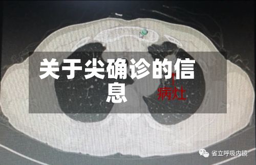 关于尖确诊的信息-第2张图片