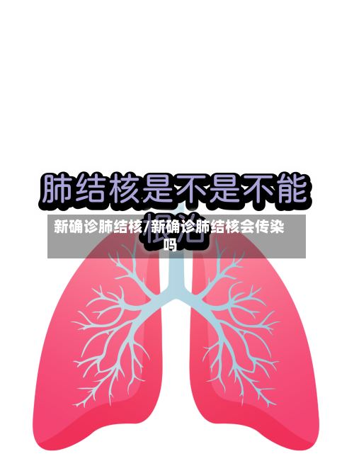 新确诊肺结核/新确诊肺结核会传染吗