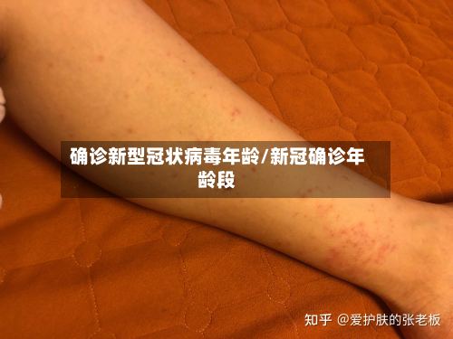 确诊新型冠状病毒年龄/新冠确诊年龄段