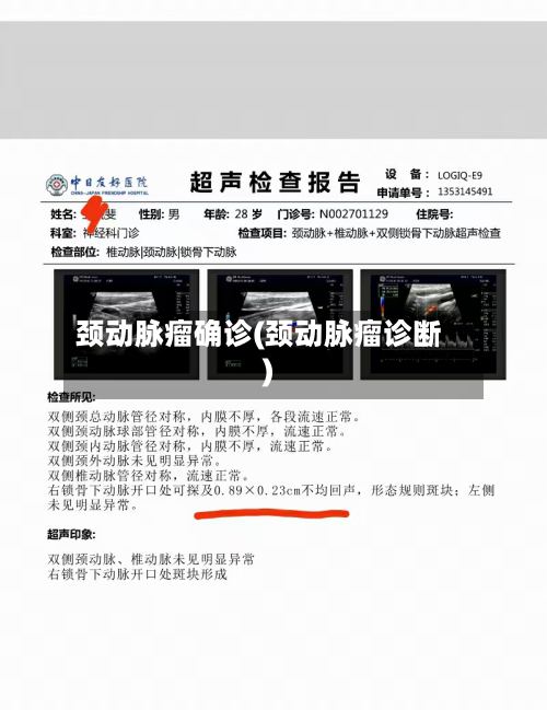 颈动脉瘤确诊(颈动脉瘤诊断)-第3张图片