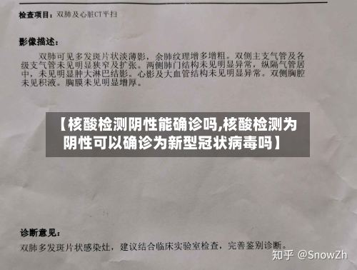 【核酸检测阴性能确诊吗,核酸检测为阴性可以确诊为新型冠状病毒吗】-第2张图片