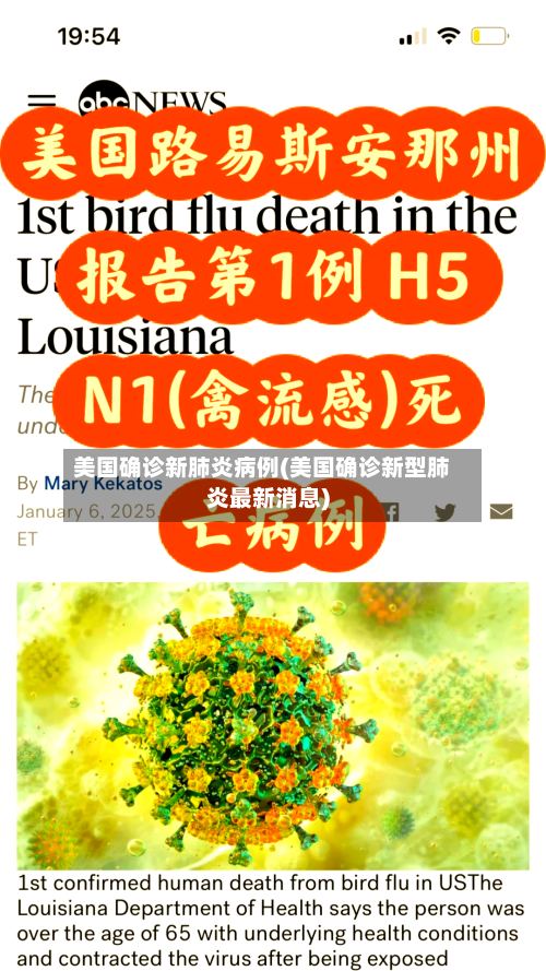 美国确诊新肺炎病例(美国确诊新型肺炎最新消息)-第2张图片