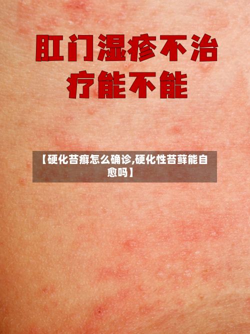 【硬化苔癣怎么确诊,硬化性苔藓能自愈吗】