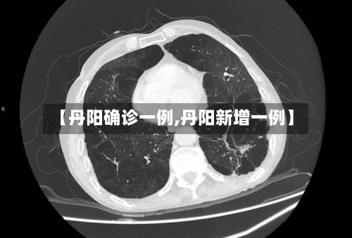 【丹阳确诊一例,丹阳新增一例】