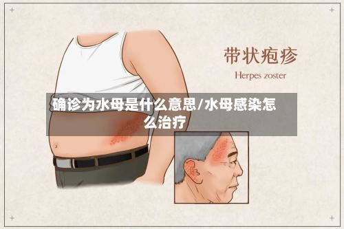 确诊为水母是什么意思/水母感染怎么治疗