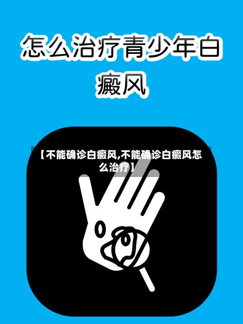 【不能确诊白癜风,不能确诊白癜风怎么治疗】-第2张图片