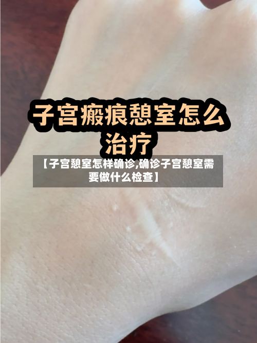 【子宫憩室怎样确诊,确诊子宫憩室需要做什么检查】-第2张图片