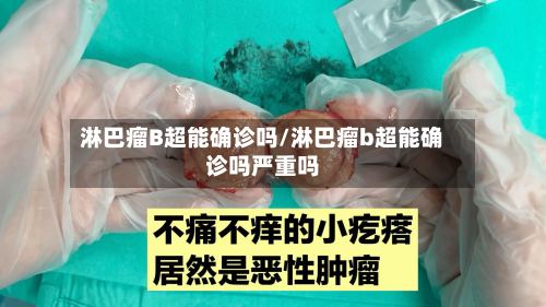 淋巴瘤B超能确诊吗/淋巴瘤b超能确诊吗严重吗-第3张图片